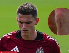 竞彩世界杯-博特曼回归阵容，但埃迪·豪的谨慎比庆祝更重要