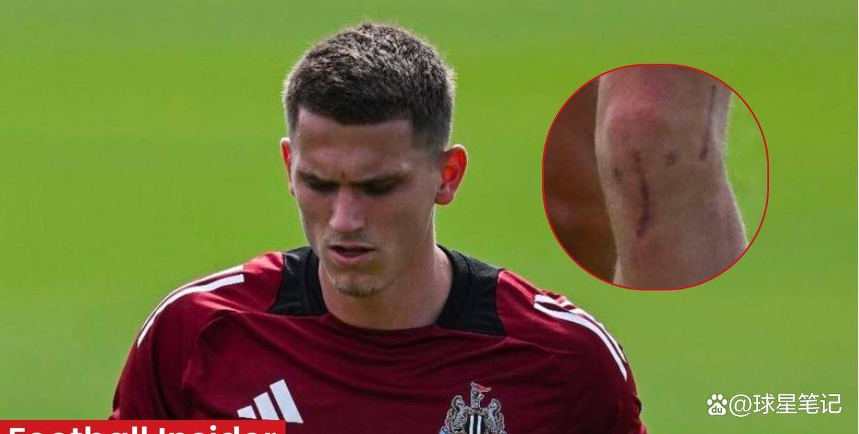 竞彩世界杯-博特曼回归阵容，但埃迪·豪的谨慎比庆祝更重要